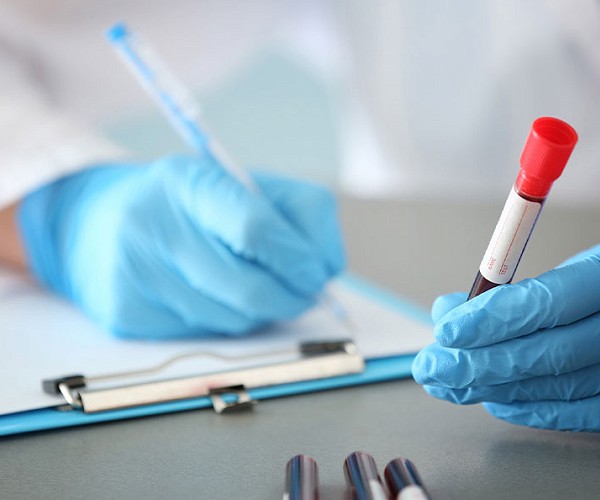 close up of a person writing on a clip board holding a vile of blood wearing gloves and a white coat